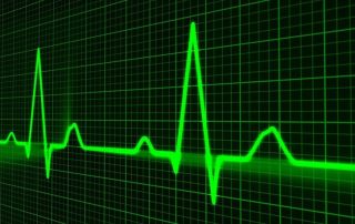 Green electrocardiogram (ECG) line displayed on a black background, showing a series of heartbeats with peaks and valleys.